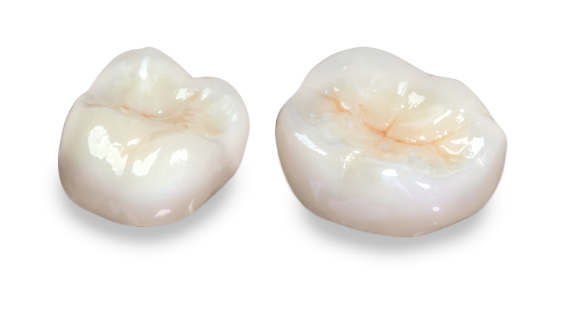bruxzir zirconia shade guide