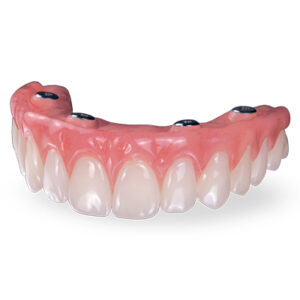 Milled Provisionals