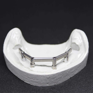 Titanium Frames Substructures