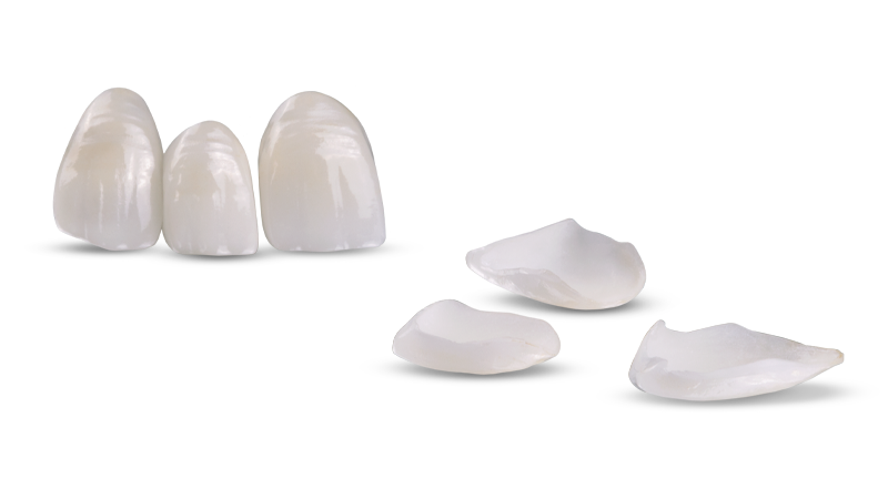 Ceramic Restorations / E.max Crowns